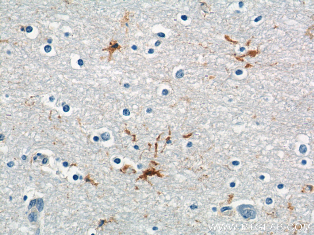 Immunohistochemistry (IHC) staining of human brain tissue using MAS1L Polyclonal antibody (21029-1-AP)