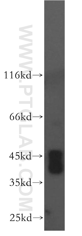 Western Blot (WB) analysis of HeLa cells using MAS1L-Specific Polyclonal antibody (20080-1-AP)