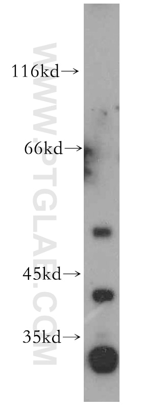 Western Blot (WB) analysis of mouse liver tissue using MAS1L-Specific Polyclonal antibody (20080-1-AP)