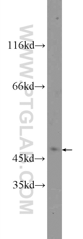 Western Blot (WB) analysis of HeLa cells using MASP1 Polyclonal antibody (21837-1-AP)