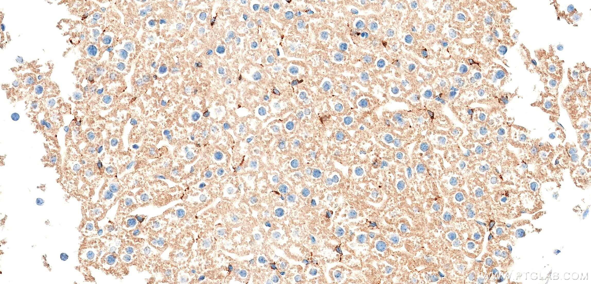 IHC staining of mouse liver using 86615-3-RR Immunohistochemistry (IHC) staining of mouse liver tissue using MASP1 Recombinant monoclonal antibody (86615-3-RR)