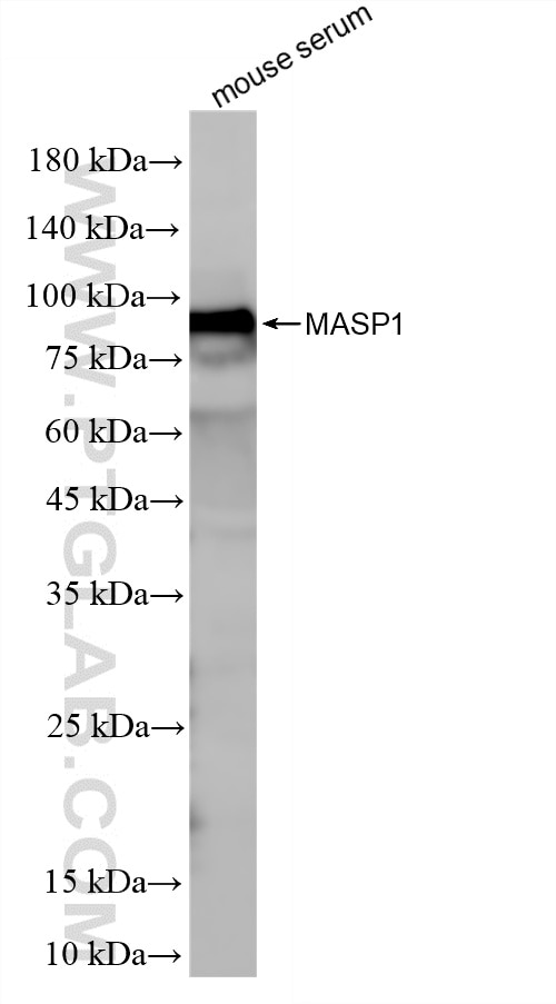 Western Blot (WB) analysis of mouse serum using MASP1 Recombinant monoclonal antibody (86615-3-RR)
