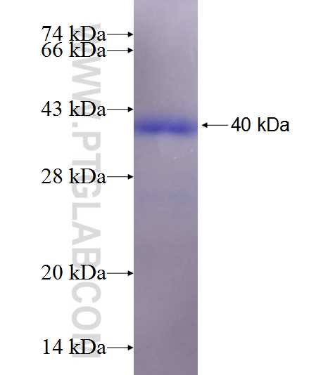 MASP1 fusion protein Ag18657 SDS-PAGE