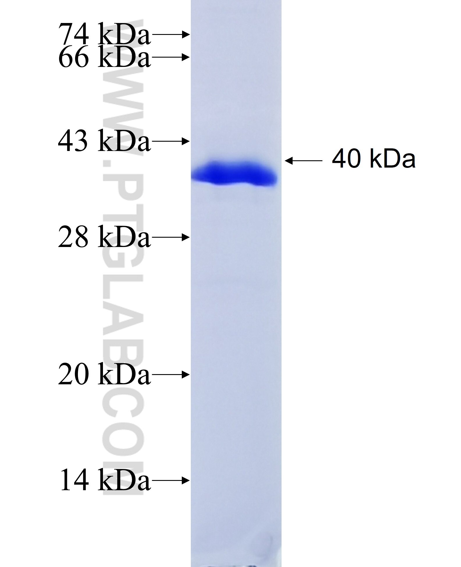 MASP1 fusion protein Ag18657 SDS-PAGE