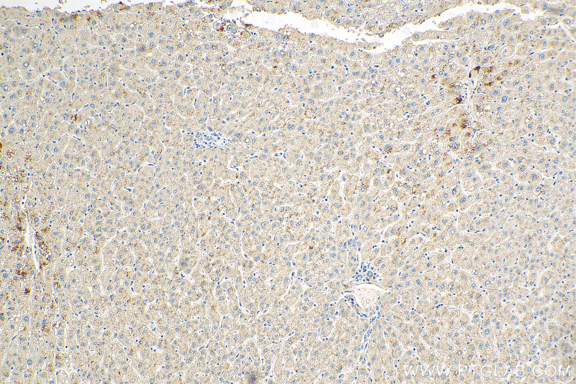 IHC staining of human liver using 55252-1-AP