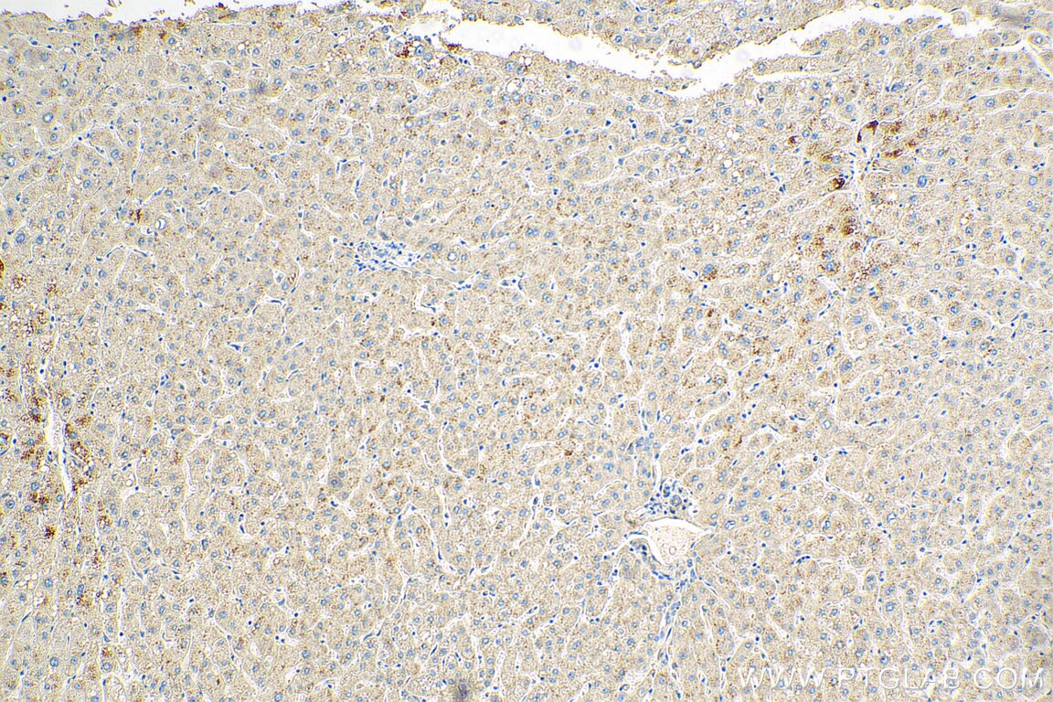 Immunohistochemistry (IHC) staining of human liver tissue using MASP2 Polyclonal antibody (55252-1-AP)