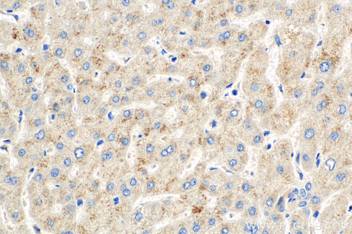 Immunohistochemistry (IHC) staining of human liver tissue using MASP2 Polyclonal antibody (55252-1-AP)