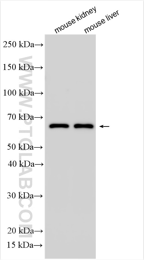 Western Blot (WB) analysis of various lysates using MASP2 Polyclonal antibody (55252-1-AP)