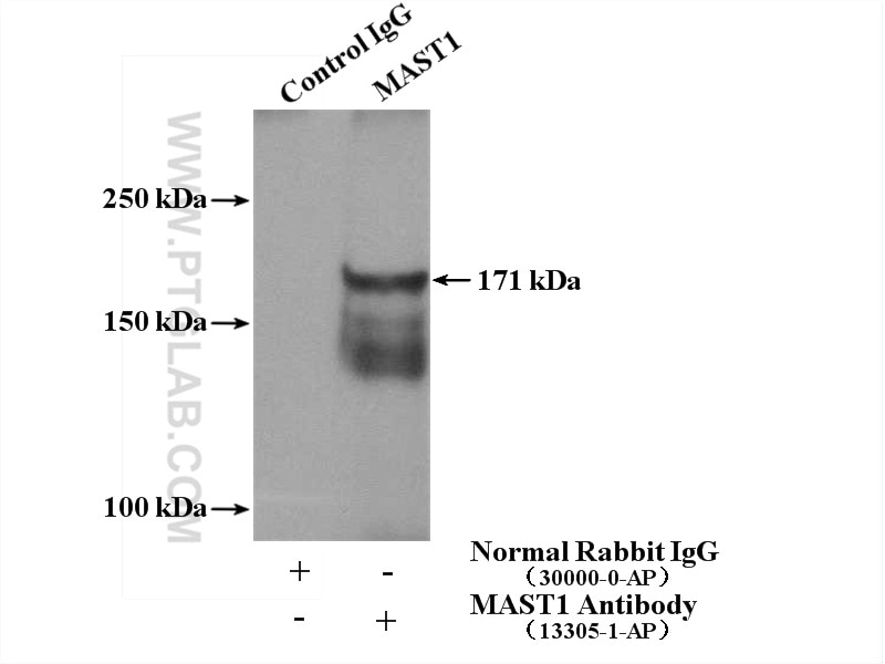 Immunoprecipitation (IP) experiment of mouse brain tissue using MAST1 Polyclonal antibody (13305-1-AP)