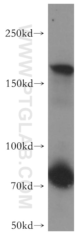 Western Blot (WB) analysis of mouse brain tissue using MAST1 Polyclonal antibody (13305-1-AP)