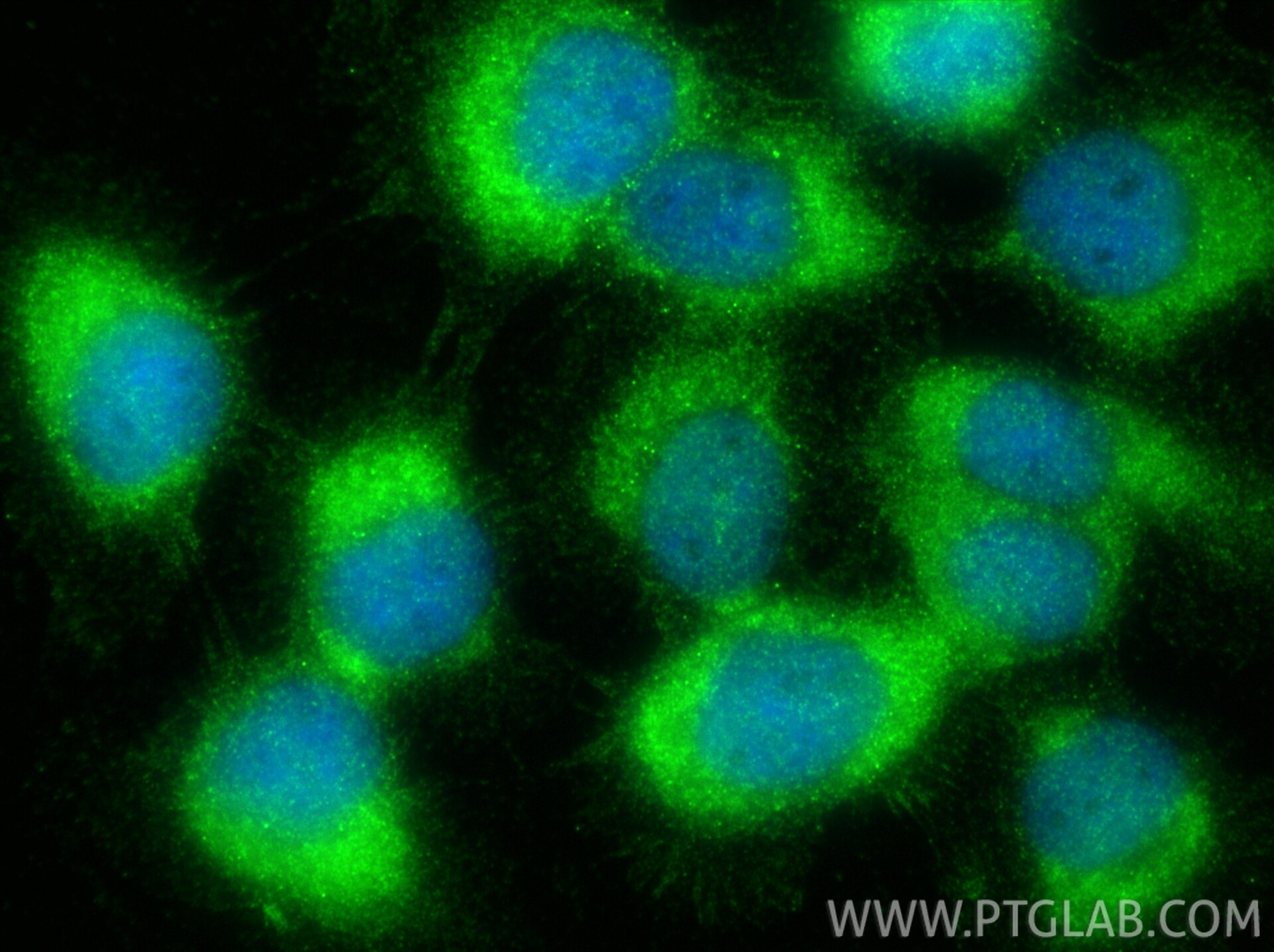 IF Staining of A431 using 33335-1-AP (same clone as 33335-1-PBS) Immunofluorescence (IF) / fluorescent staining of A431 cells using MAST2 Polyclonal antibody (33335-1-AP)