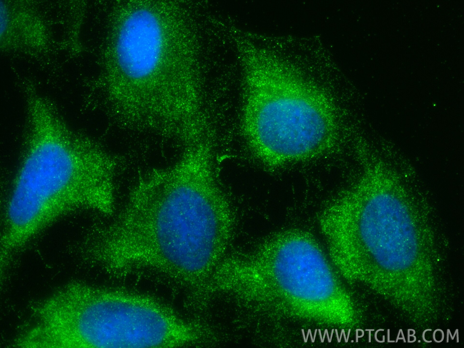 IF Staining of U2OS using 33335-1-AP (same clone as 33335-1-PBS) Immunofluorescence (IF) / fluorescent staining of U2OS cells using MAST2 Polyclonal antibody (33335-1-AP)