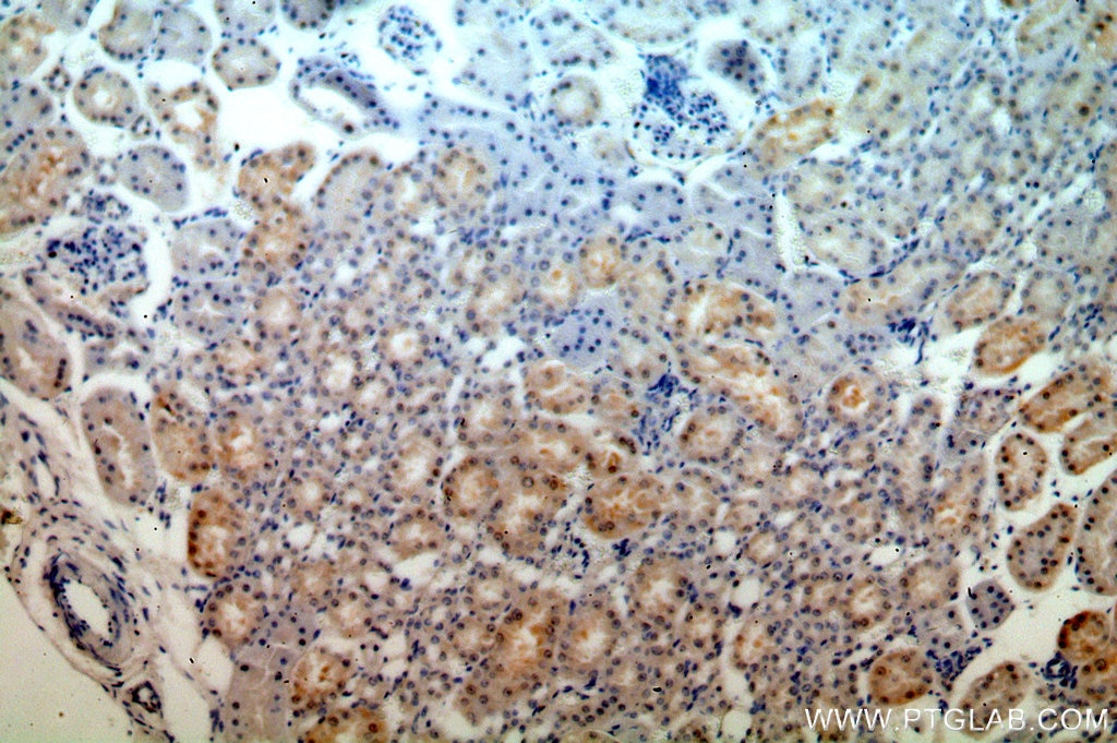 Immunohistochemistry (IHC) staining of human kidney tissue using MAST3 Polyclonal antibody (19507-1-AP)