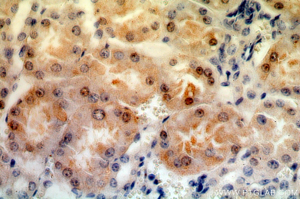 Immunohistochemistry (IHC) staining of human kidney tissue using MAST3 Polyclonal antibody (19507-1-AP)