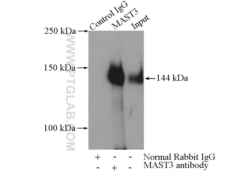 Immunoprecipitation (IP) experiment of Jurkat cells using MAST3 Polyclonal antibody (19507-1-AP)