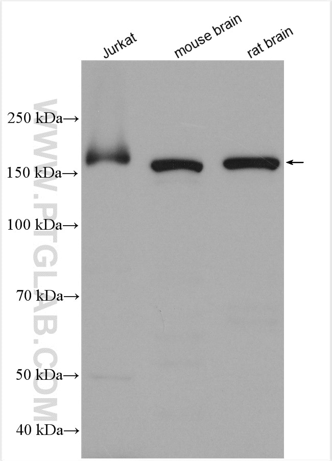 Western Blot (WB) analysis of various lysates using MAST3 Polyclonal antibody (19507-1-AP)