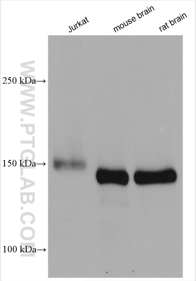 Western Blot (WB) analysis of various lysates using MAST3 Polyclonal antibody (19507-1-AP)