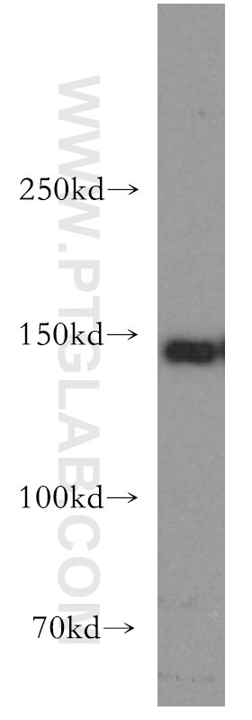 Western Blot (WB) analysis of human brain tissue using MAST3 Polyclonal antibody (19507-1-AP)