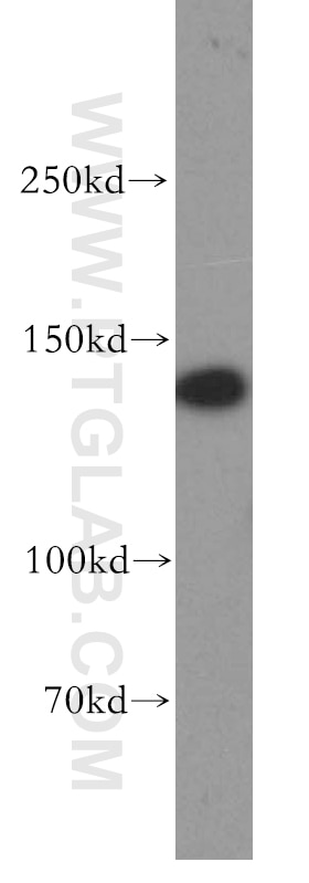 Western Blot (WB) analysis of human brain tissue using MAST3 Polyclonal antibody (19507-1-AP)