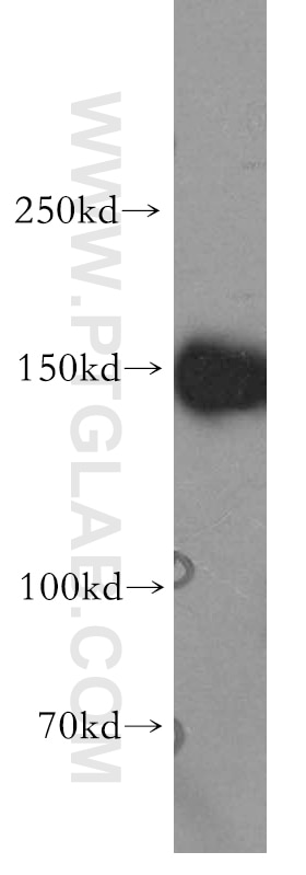 Western Blot (WB) analysis of Jurkat cells using MAST3 Polyclonal antibody (19507-1-AP)