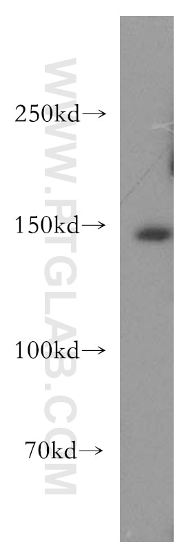 Western Blot (WB) analysis of mouse lung tissue using MAST3 Polyclonal antibody (19507-1-AP)