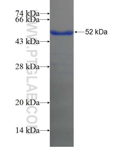MAST4 fusion protein Ag24431 SDS-PAGE