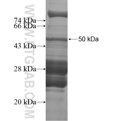 MAST4 fusion protein Ag14432 SDS-PAGE