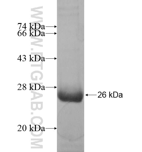 MAST4 fusion protein Ag14818 SDS-PAGE