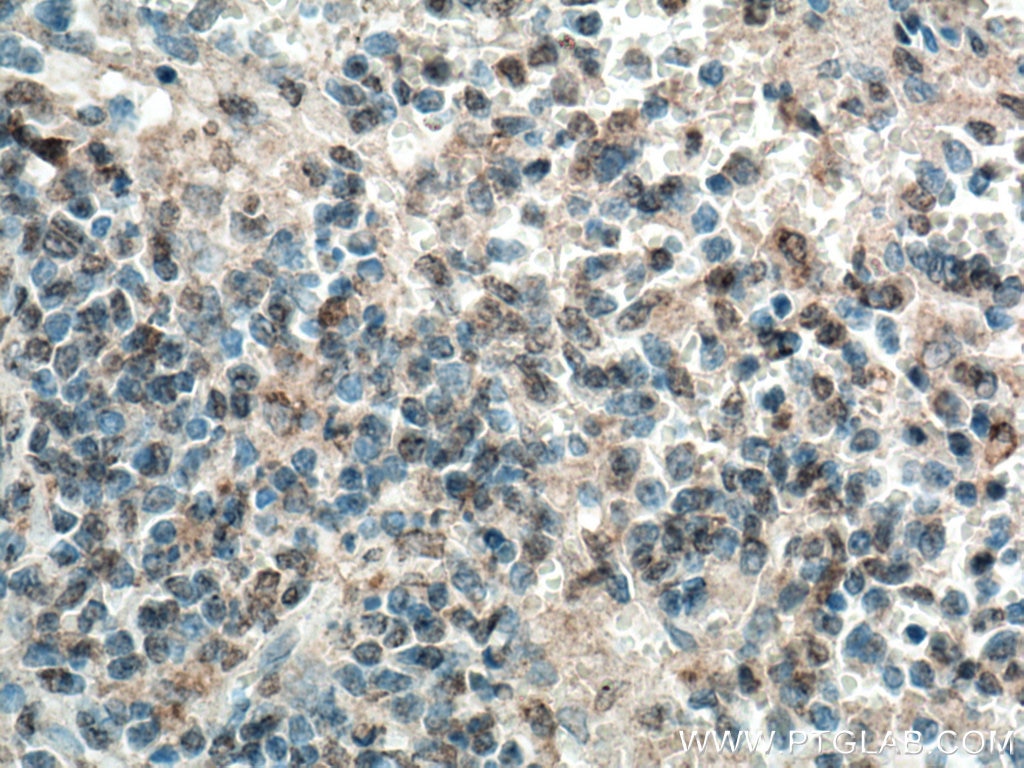 Immunohistochemistry (IHC) staining of human spleen tissue using MASTL Polyclonal antibody (15739-1-AP)