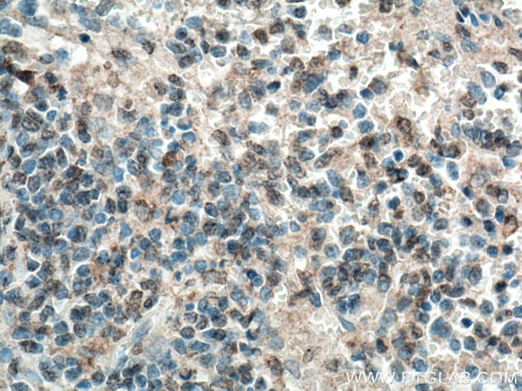 IHC staining of human spleen using 15739-1-AP