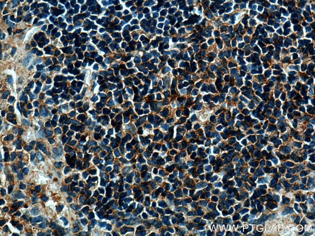 Immunohistochemistry (IHC) staining of mouse spleen tissue using MASTL Polyclonal antibody (15739-1-AP)