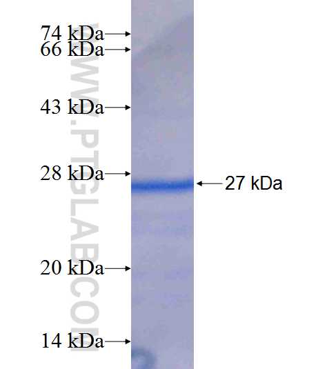 MASTL fusion protein Ag9662 SDS-PAGE