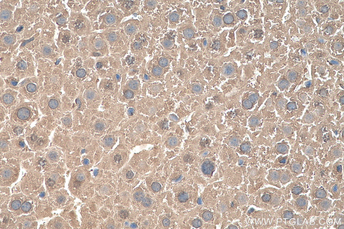 Immunohistochemistry (IHC) staining of mouse liver tissue using MAT1A/MAT2A Polyclonal antibody (12395-1-AP)