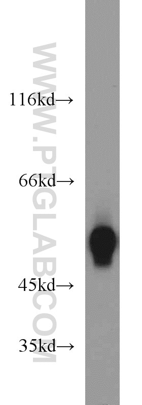 Western Blot (WB) analysis of mouse liver tissue using MAT1A/MAT2A Polyclonal antibody (12395-1-AP)