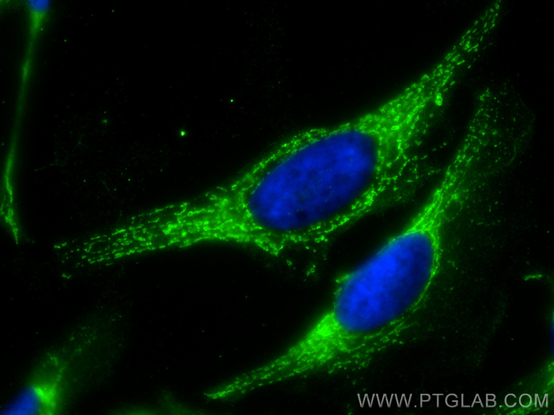 Immunofluorescence (IF) / fluorescent staining of HeLa cells using MAT1A Monoclonal antibody (67408-1-Ig)