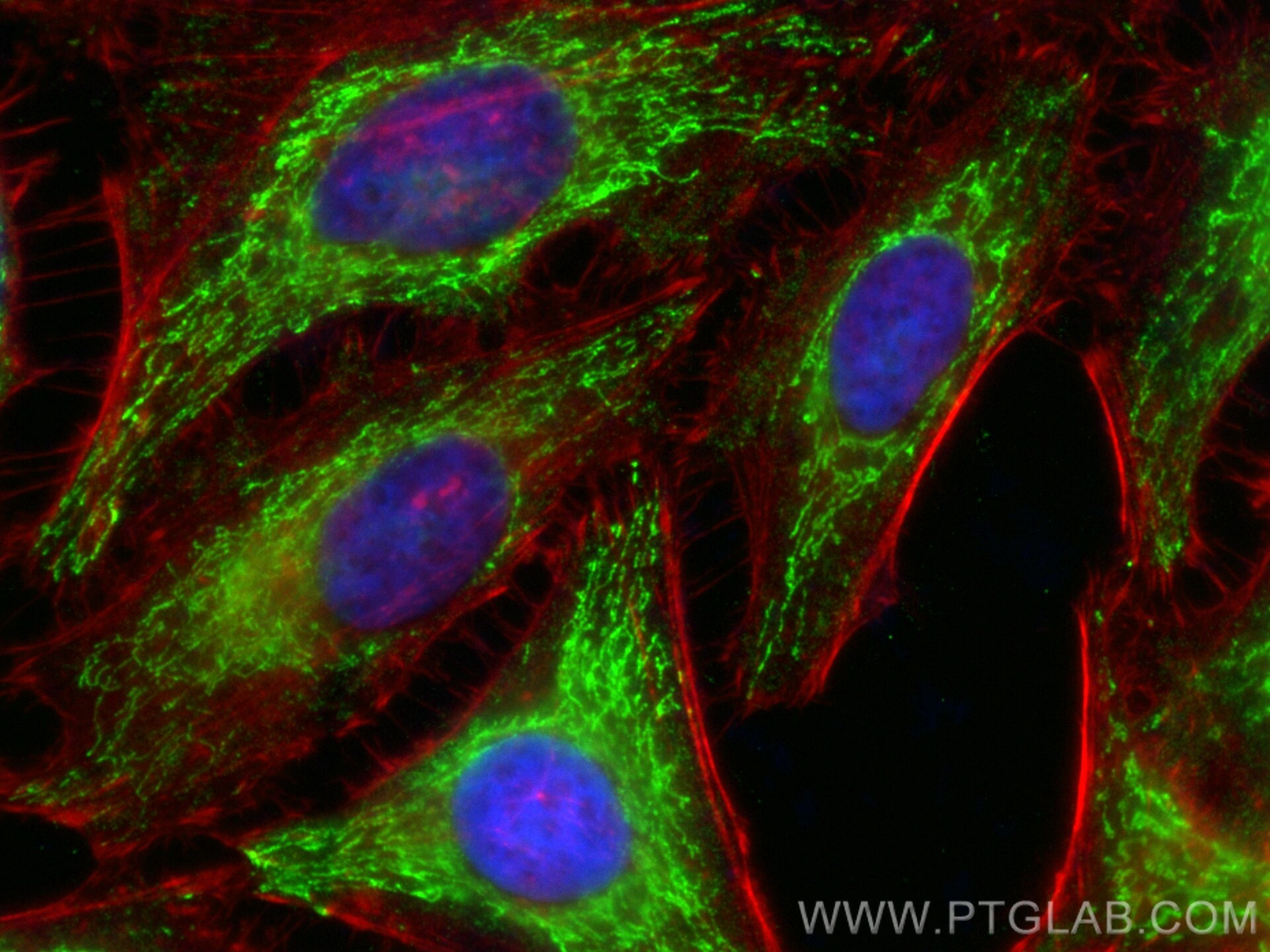 IF Staining of HeLa using CL488-67408