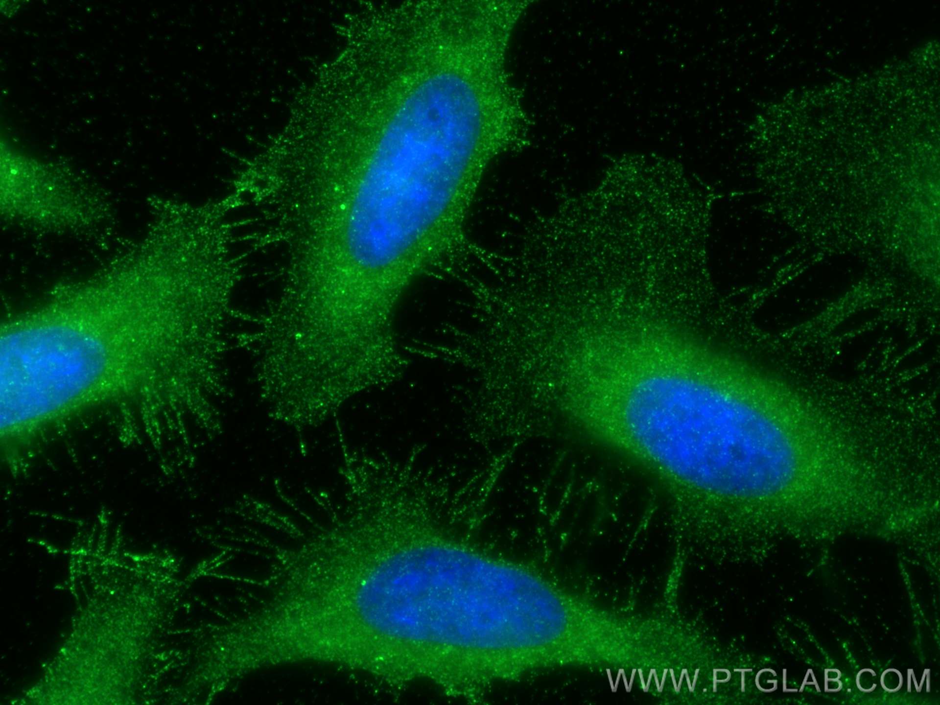 Immunofluorescence (IF) / fluorescent staining of HeLa cells using MAT2A Polyclonal antibody (55309-1-AP)