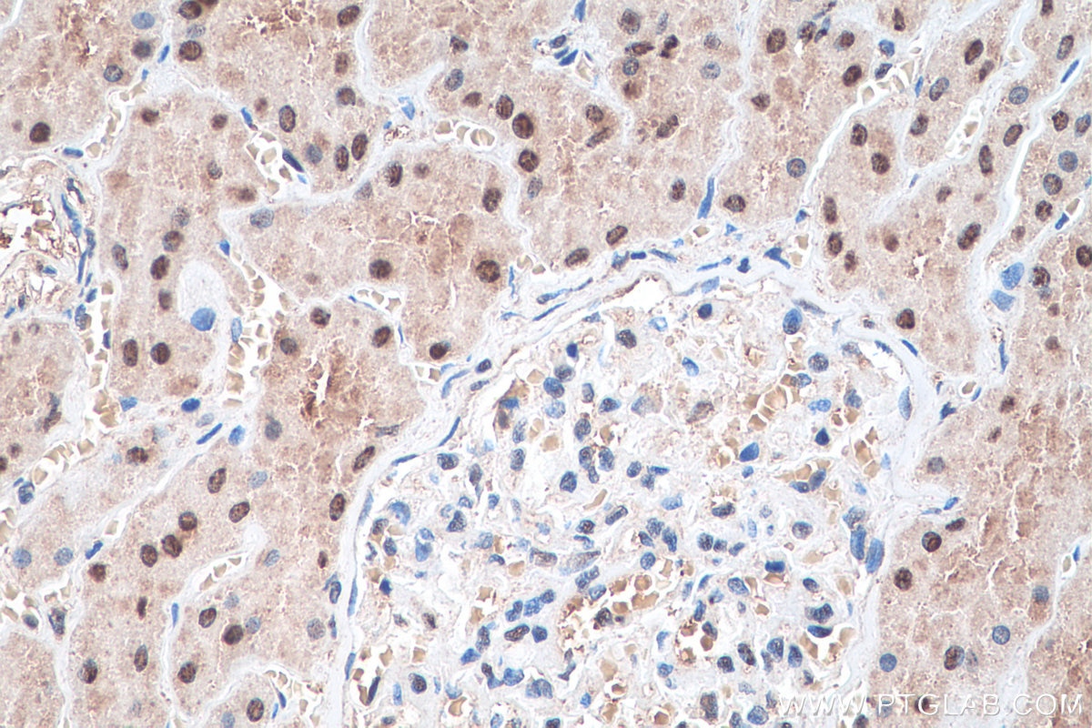 Immunohistochemistry (IHC) staining of human kidney tissue using MAT2A Polyclonal antibody (55309-1-AP)