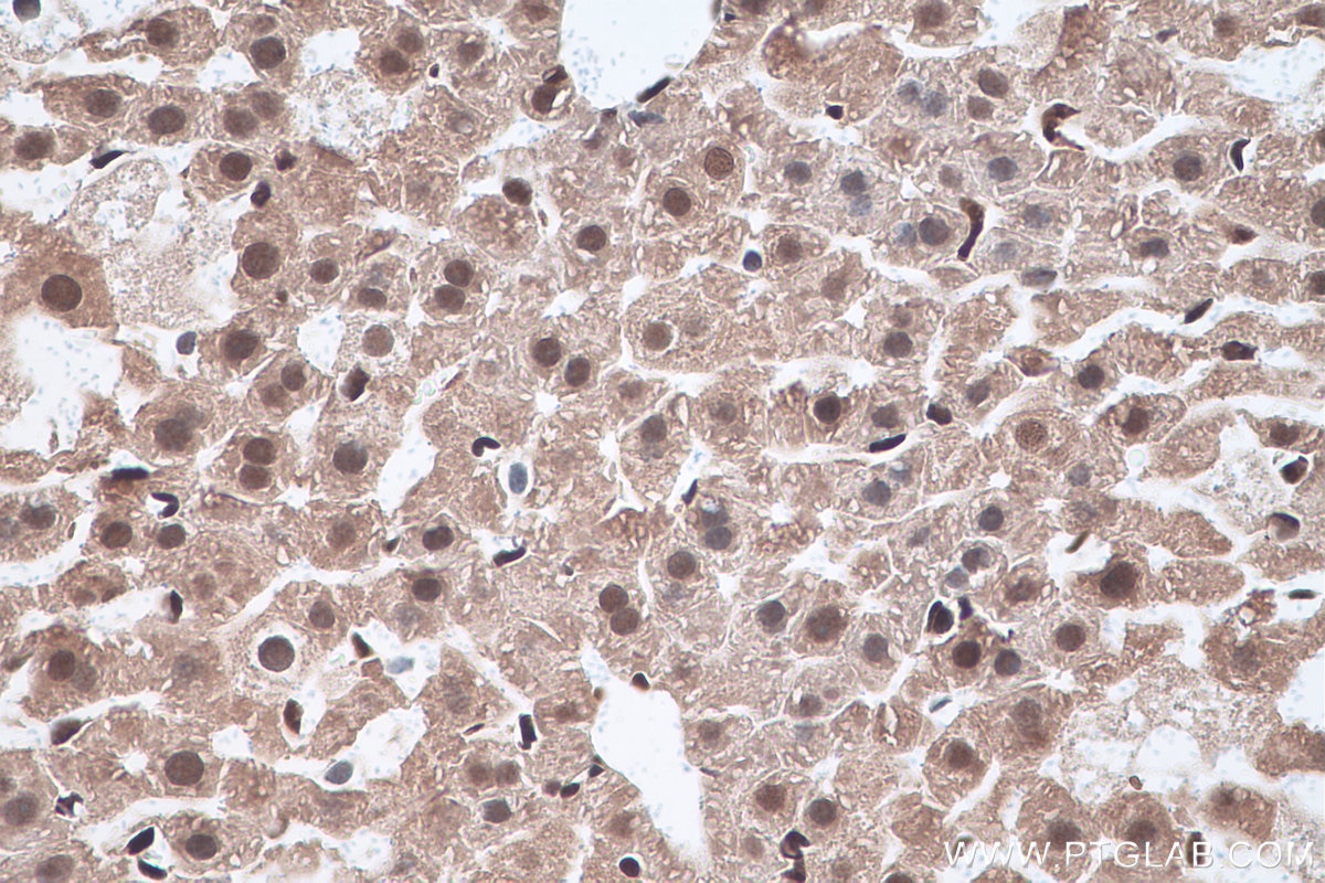 Immunohistochemistry (IHC) staining of mouse liver tissue using MAT2A Polyclonal antibody (55309-1-AP)