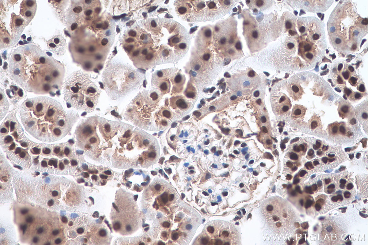 Immunohistochemistry (IHC) staining of rat kidney tissue using MAT2A Polyclonal antibody (55309-1-AP)