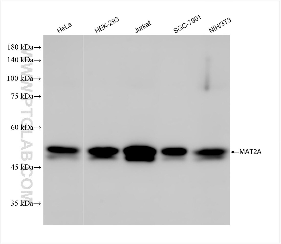 Western Blot (WB) analysis of various lysates using MAT2A Recombinant antibody (84698-1-RR)