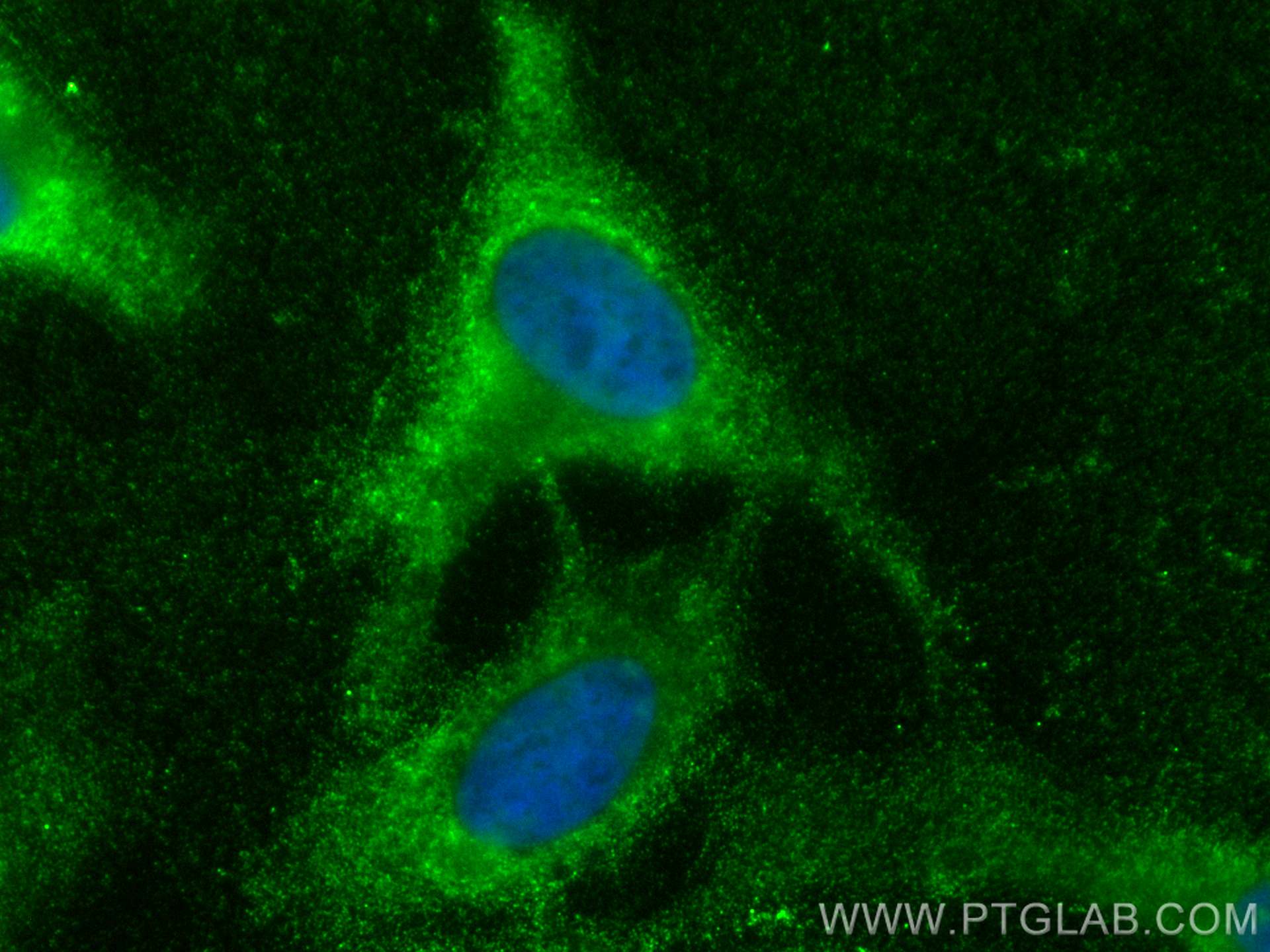 Immunofluorescence (IF) / fluorescent staining of HeLa cells using CoraLite® Plus 488-conjugated MAT2A Polyclonal ant (CL488-55309)