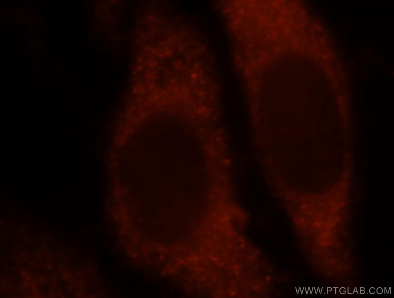 Immunofluorescence (IF) / fluorescent staining of HepG2 cells using MAT2B Polyclonal antibody (15952-1-AP)