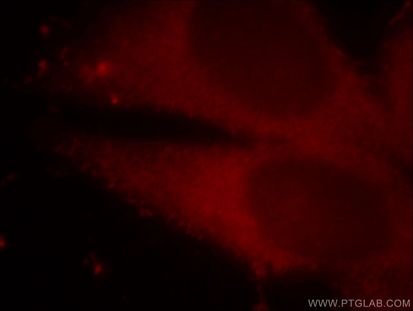 Immunofluorescence (IF) / fluorescent staining of HepG2 cells using MAT2B Polyclonal antibody (15952-1-AP)