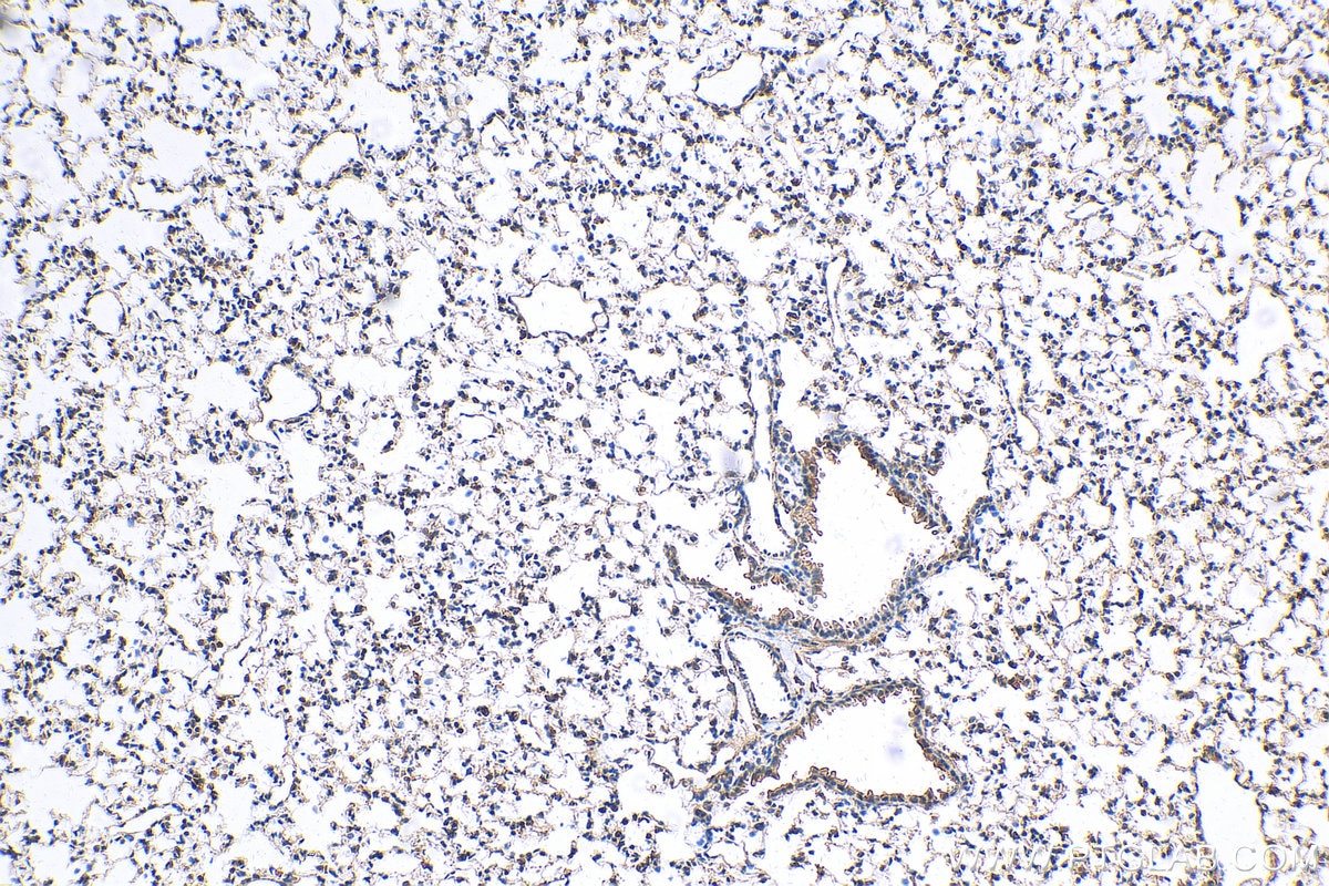 Immunohistochemistry (IHC) staining of mouse lung tissue using MAT2B Polyclonal antibody (15952-1-AP)
