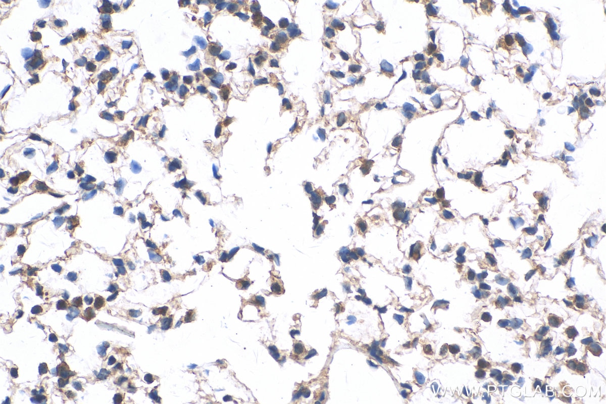 Immunohistochemistry (IHC) staining of mouse lung tissue using MAT2B Polyclonal antibody (15952-1-AP)
