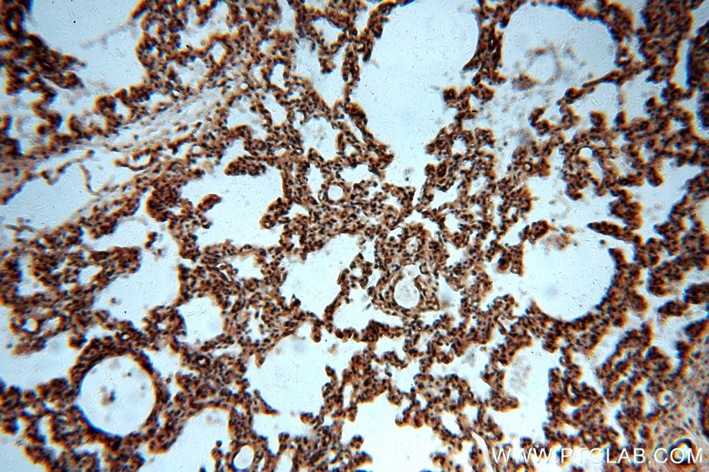 Immunohistochemistry (IHC) staining of human lung tissue using MAT2B Polyclonal antibody (15952-1-AP)