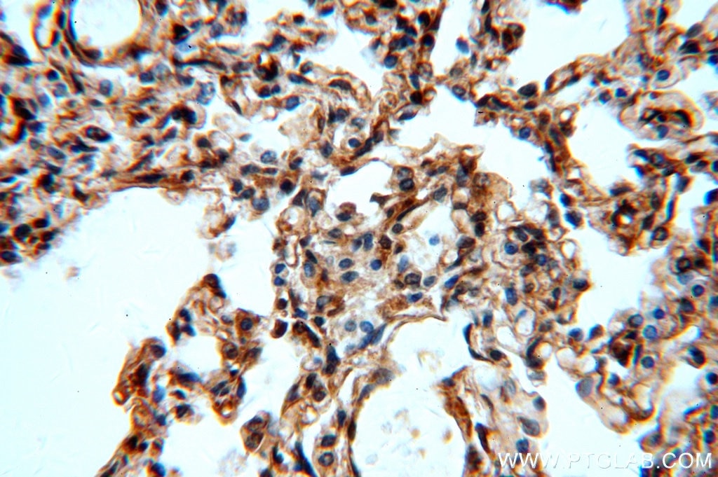 IHC staining of human lung using 15952-1-AP