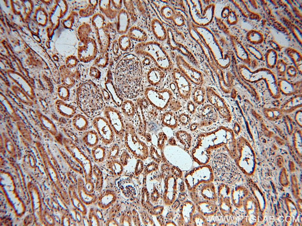 Immunohistochemistry (IHC) staining of human kidney tissue using MAT2B Polyclonal antibody (15952-1-AP)