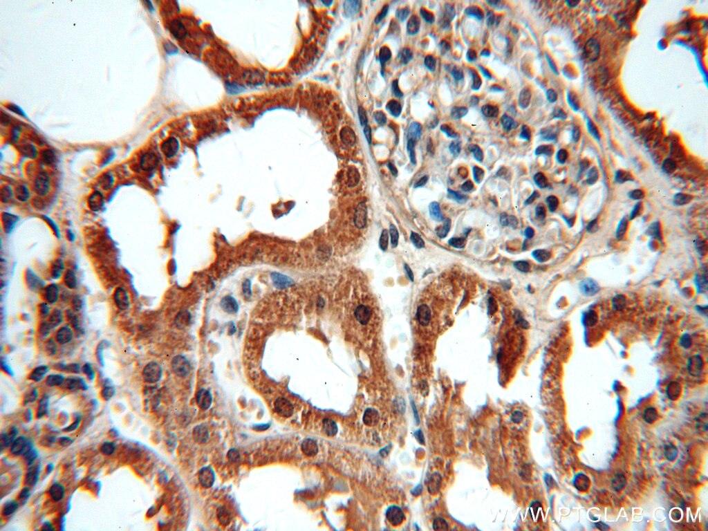 Immunohistochemistry (IHC) staining of human kidney tissue using MAT2B Polyclonal antibody (15952-1-AP)